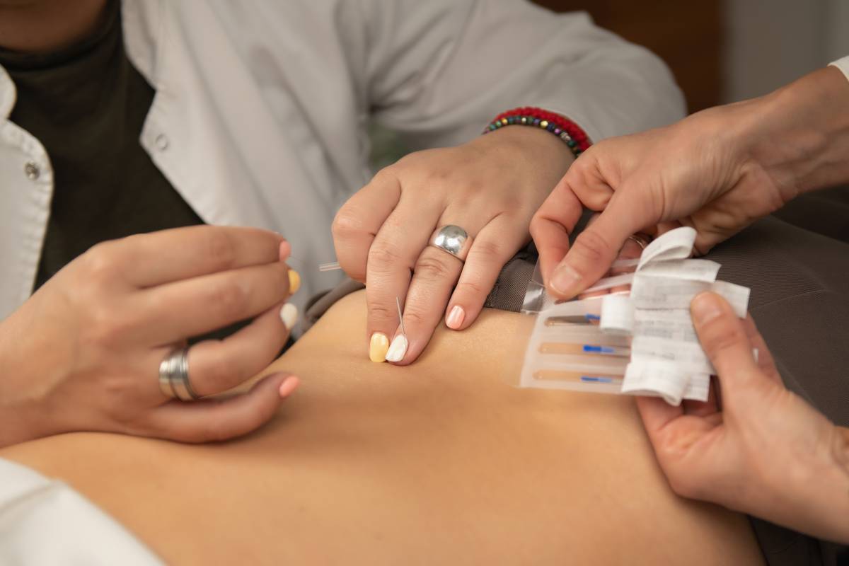 sciatica-back-pain-acupuncture-treatment-2024-10-18-19-31-56-utc (1)